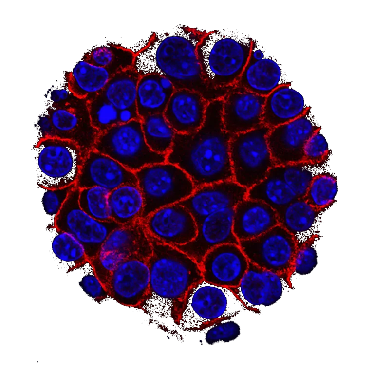 KSB Tumor Markers